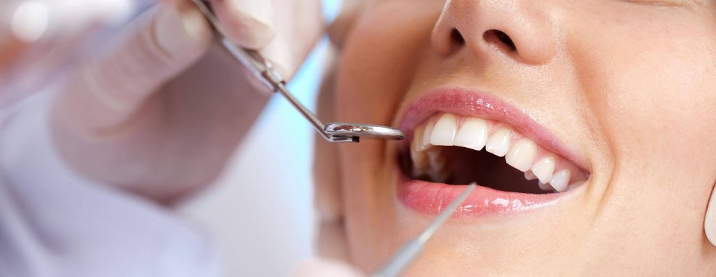 teeth cleaning concord nc