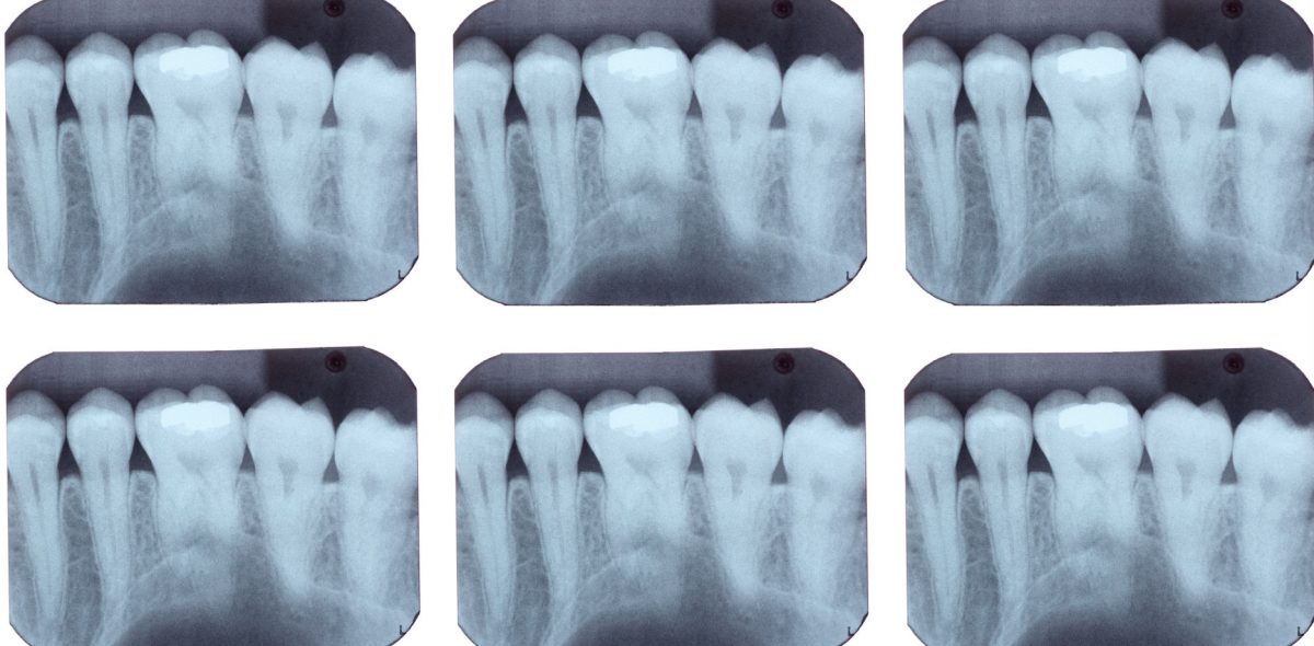 dental xray