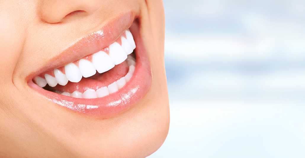  teeth whitening services