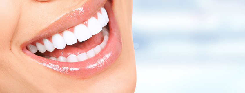 IMG_ALT_West_Lakes_Dentistry_150