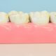 IMG_ALT_West_Lakes_Dentistry_28