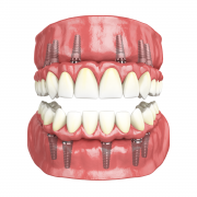 IMG_ALT_West_Lakes_Dentistry_20