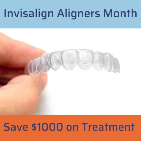 Invisalign Callout