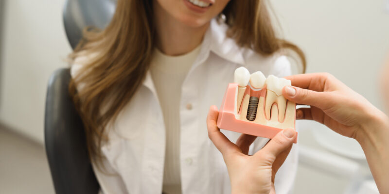 Questions to Ask Before Getting a Tooth Implant