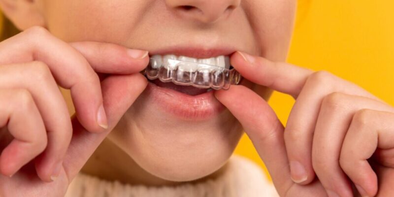 8 fast and effective tips for wearing invisalign