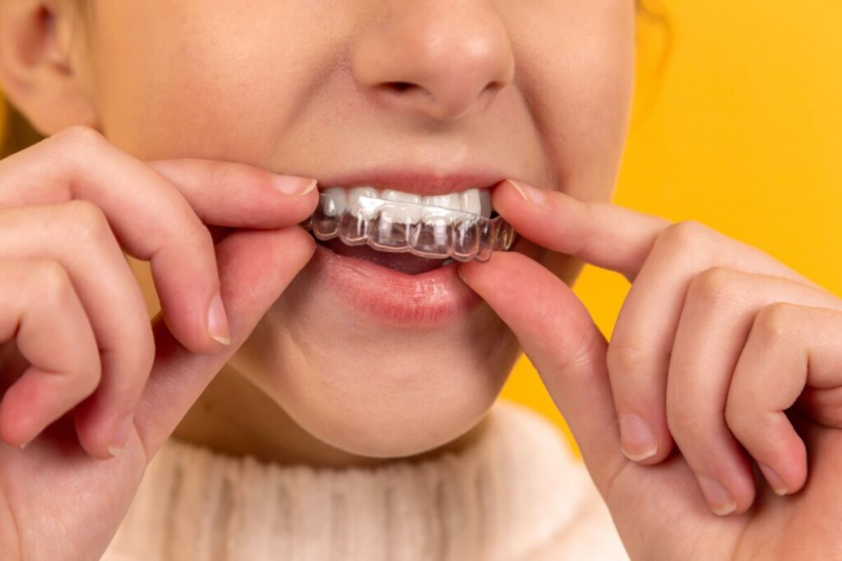 8 fast and effective tips for wearing invisalign